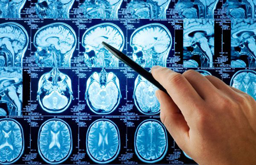 Общие положения нового Порядка установления диагноза смерти мозга человека