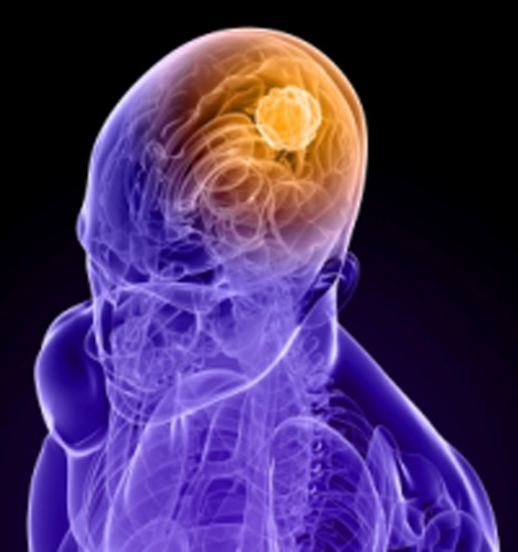 Прекращение процедуры установления диагноза смерти мозга человека в случае установления отсутствия биоэлектрической активности мозга по результатам ЭЭГ-исследования