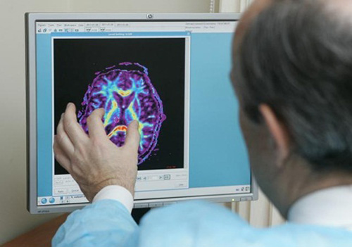 Клинические критерии смерти мозга человека