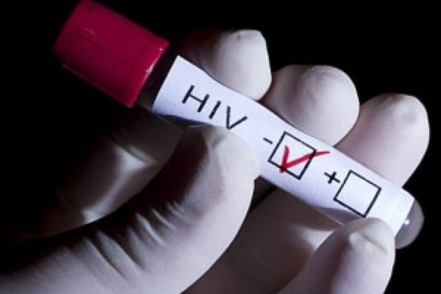 Лабораторная диагностика ВИЧ-инфекции