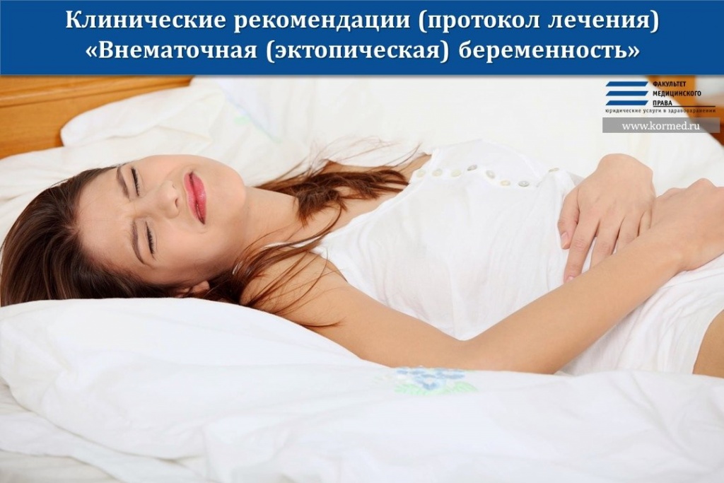 Клинические рекомендации (протокол лечения) «Внематочная (эктопическая) беременность»