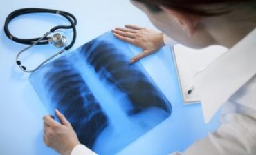 О новых Порядке и сроках проведения профилактических медицинских осмотров граждан в целях выявления туберкулеза