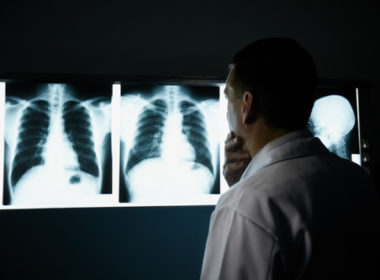 Утвержден новый порядок диспансерного наблюдения по туберкулезному профилю